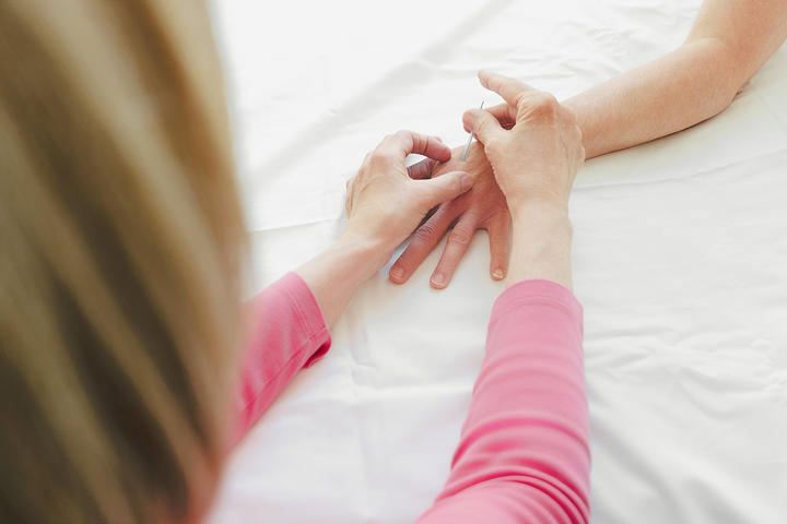 Practitioner inserts an acupuncture needle into a person’s hand while they lie on a white sheet.
